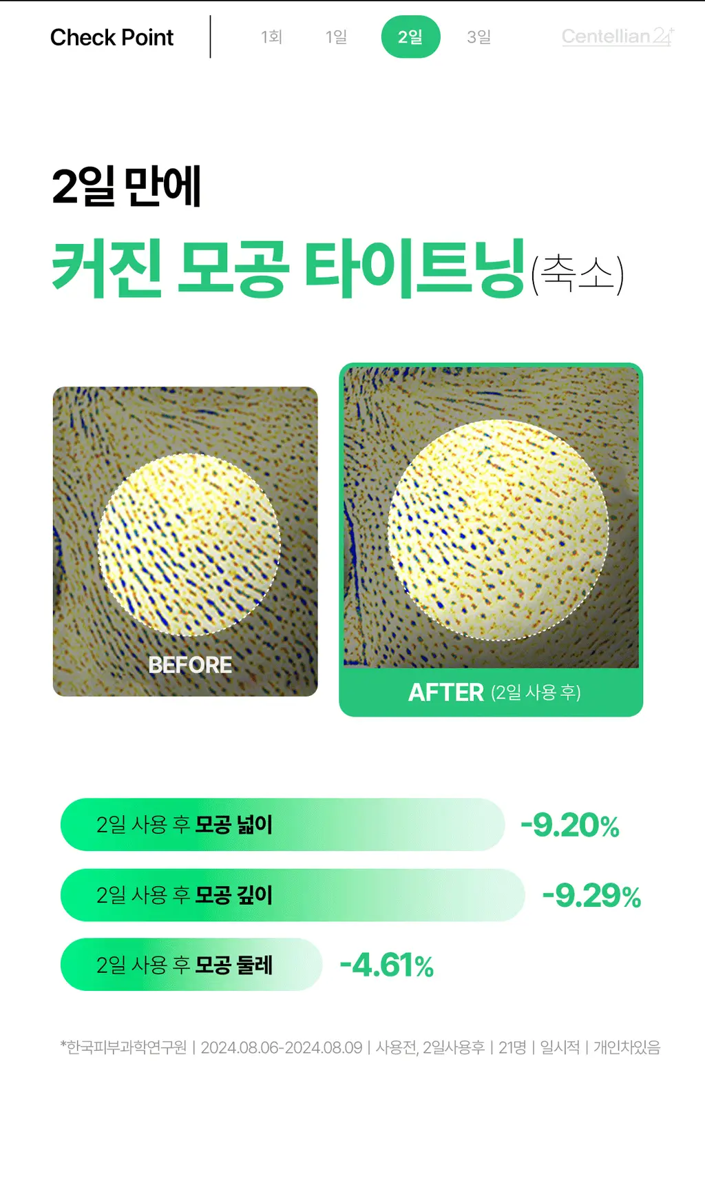 [1등 모공세럼] 센텔리안24 마데카 분말 티트리 에이씨 기획 (겔 세럼 15ml) 상세페이지 17